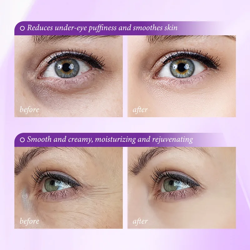 Instant oogzakverwijderingscrè - Retinol Anti Wrinkle Cream recensie en prijs